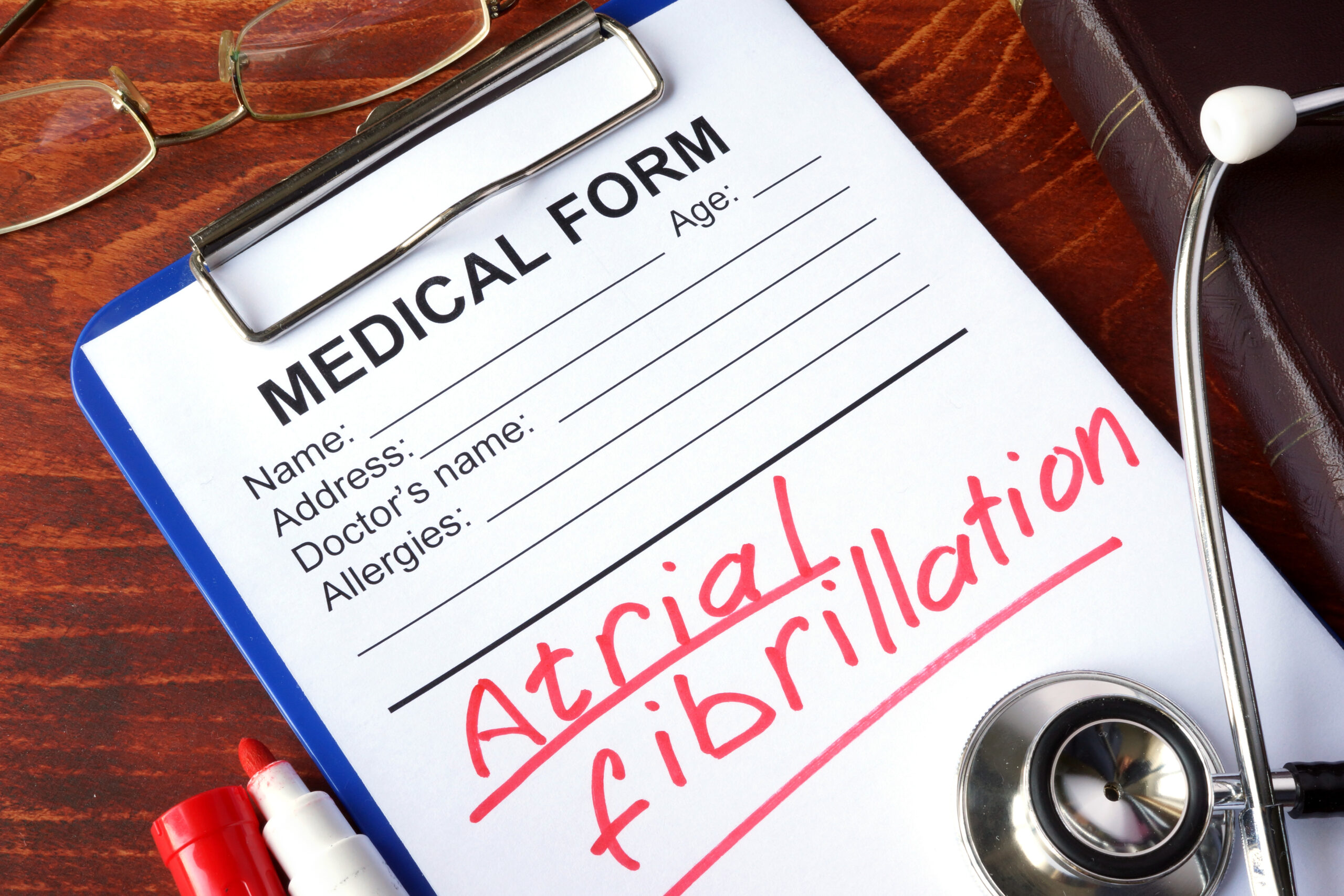 How to Prevent an Atrial Fibrillation Attack