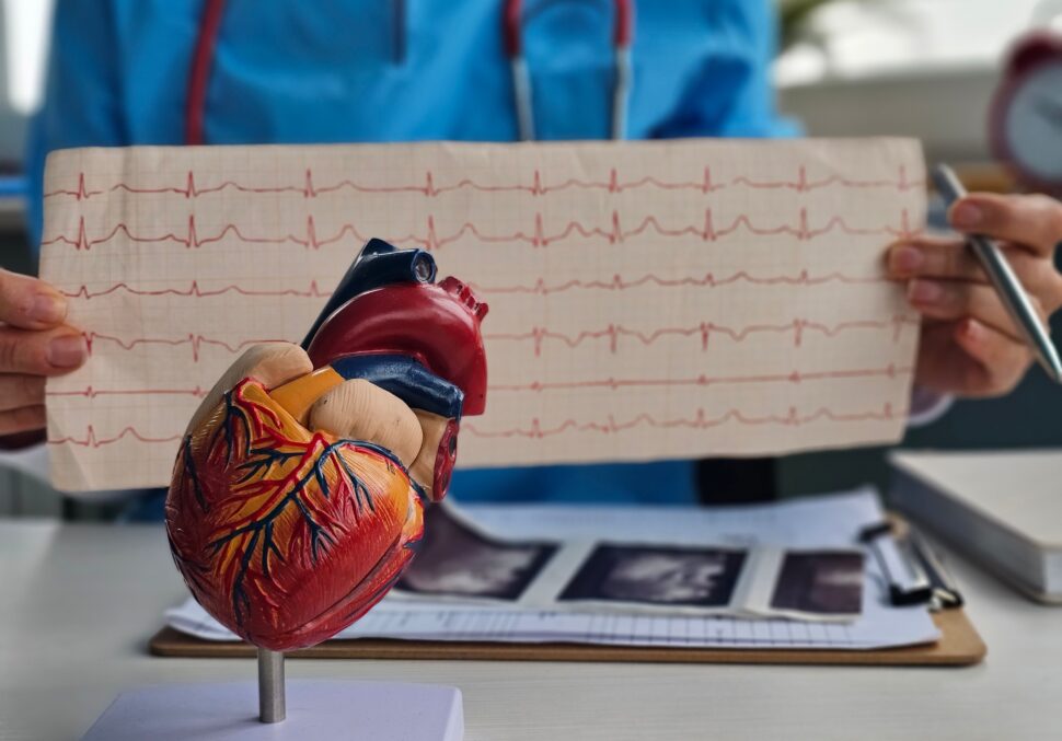 Doctor cardiologist examining electrocardiogram on background of artificial model of heart.